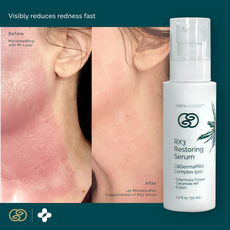 RX3 Restoring Serum - 1oz_CBDee